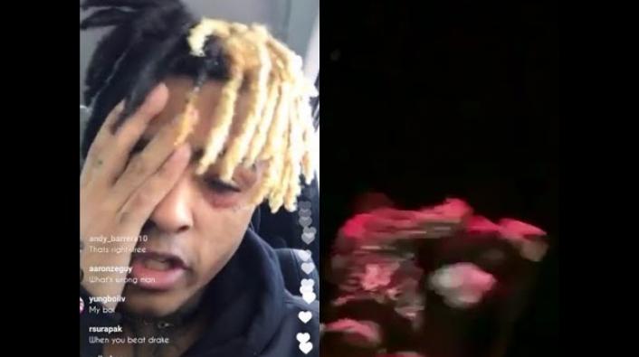 Xxxtentacion Responds To Getting Jumped Says It Was A Set Up 